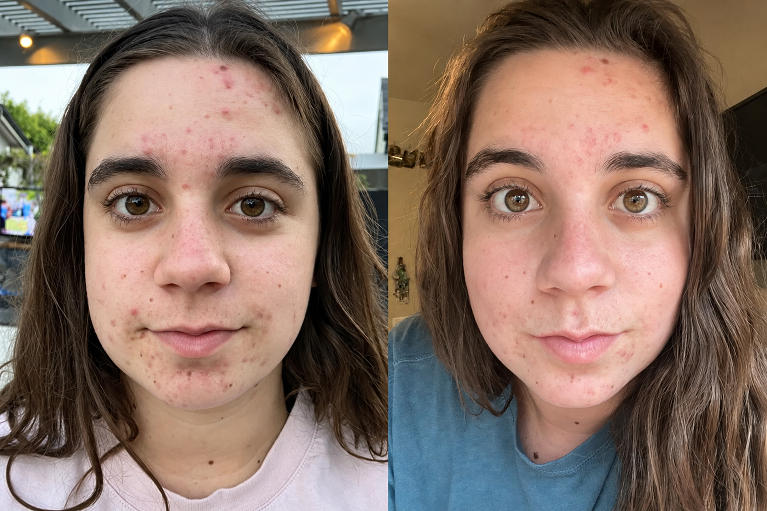 Avant et après un soin dermatologique